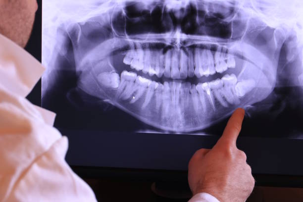 Best Walk-In Emergency Dentist in Grapevine, TX